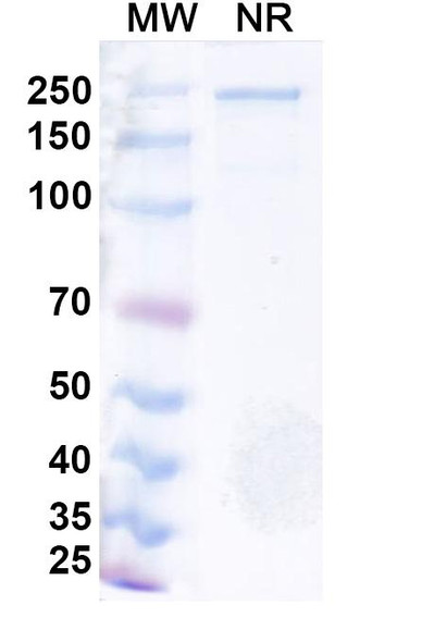Azirkitug Antibody - SDS-PAGE