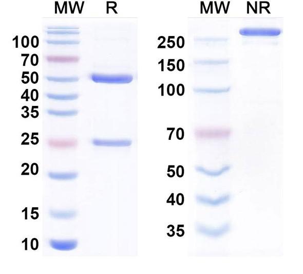 Human CTSS/Cathepsin S Antibody (Fsn0503h) - SDS-PAGE