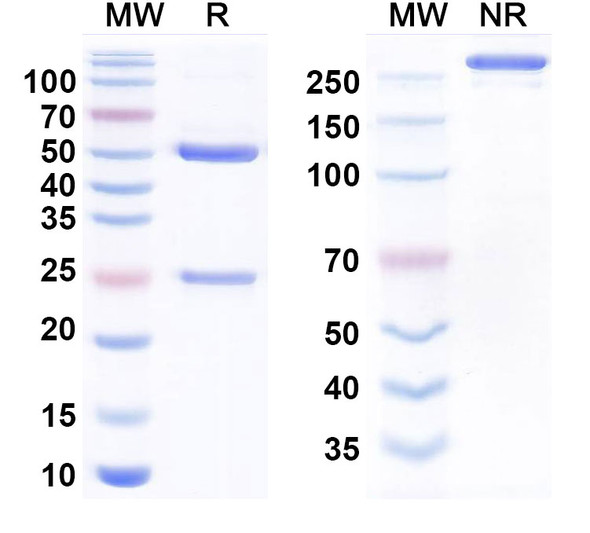 Human CD46 Antibody (FOR46) (ADC, Payload-Free) - SDS-PAGE