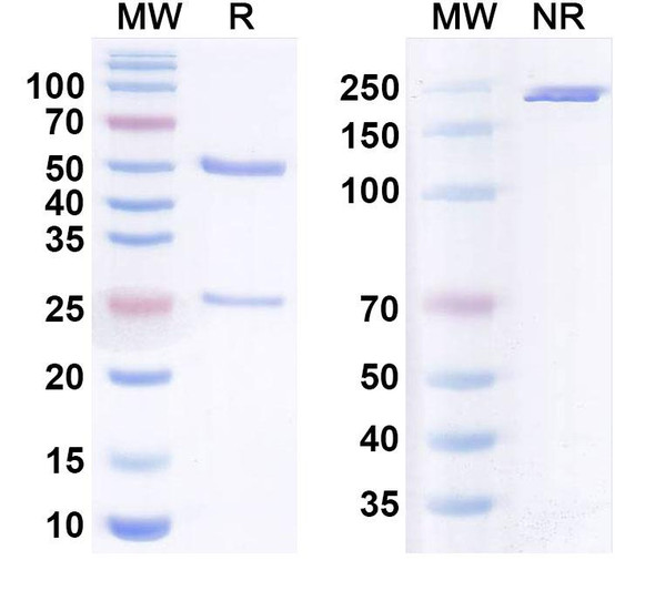 Human C1q Antibody (ANX005) - SDS-PAGE