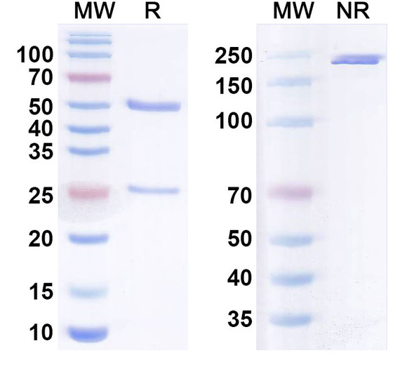 Anti-ChoPPhosphorylcholine Antibody (ATH3G10) - SDS-PAGE