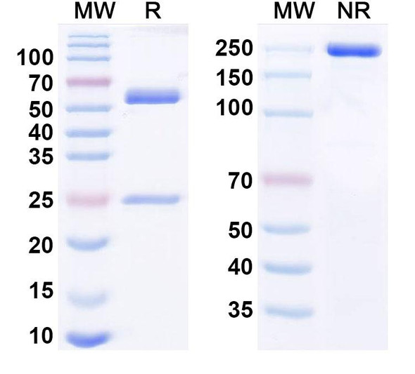 Human Reticulon-4/RTN4 Antibody (NG-101) - SDS-PAGE