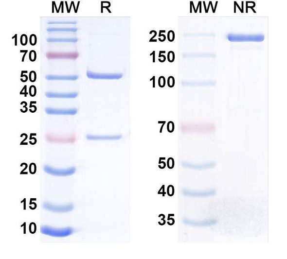 Human MAGEA4 Antibody (Imc-C103C) - SDS-PAGE