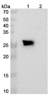Cinrebafusp alfa (Research-Grade) - WB