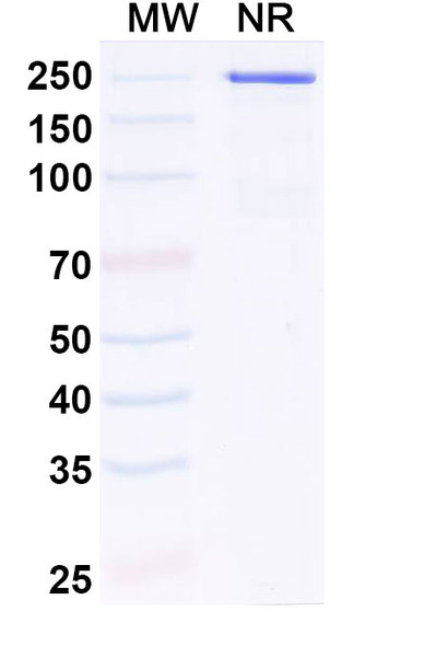 Human IL11RA Antibody (LASN 01) - SDS-PAGE