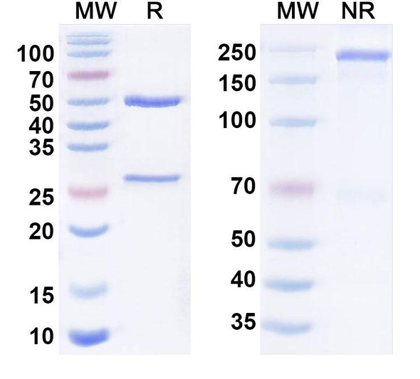 Anti-LPA/Lysophosphatidic acid Antibody (504B3) - SDS-PAGE