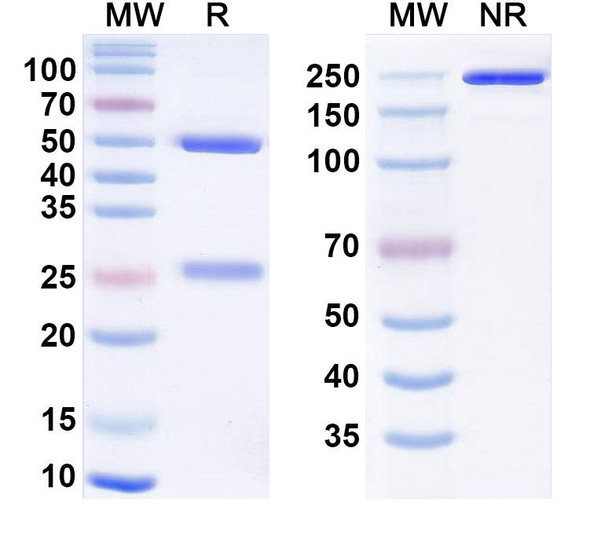 Cenzestotug Antibody - SDS-PAGE