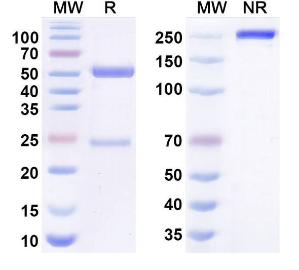 Aletekitug Antibody - SDS-PAGE