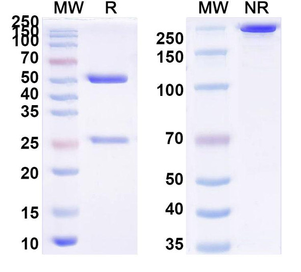 Anti-CVB1 Mature virion in complex Monoclonal In Vivo Antibody - Low Endotoxin (Iv0143) - SDS-PAGE