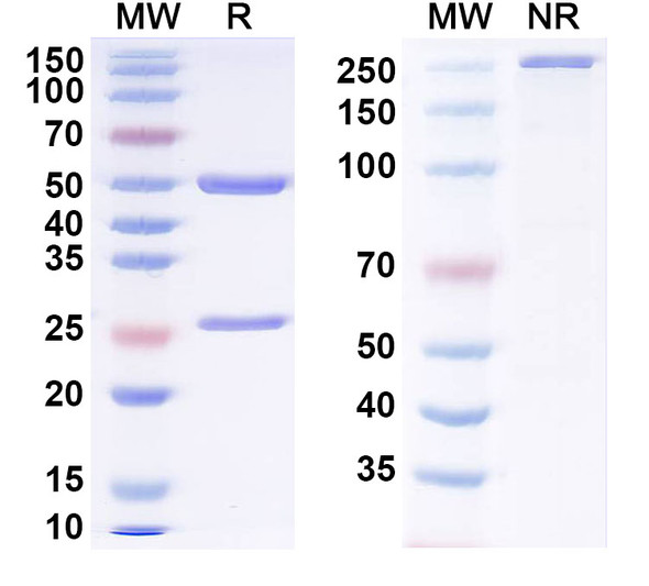 Anti-Human NEU1/Sialidase-1 Antibody (1A039) - SDS-PAGE