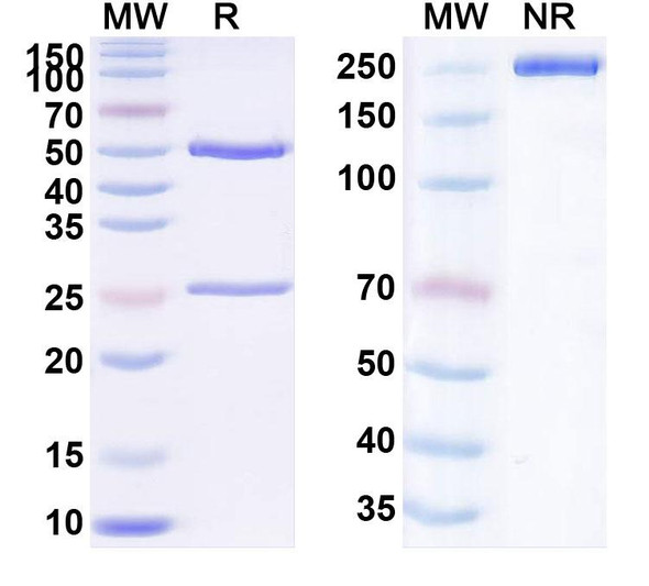 Anti-Human LTF/Lactotransferrin Antibody (1A045) - SDS-PAGE