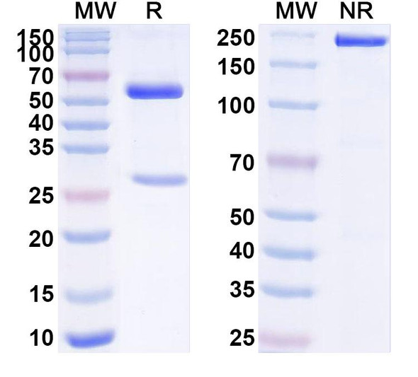Anti-Human IL1RL1/ST2 Antibody (1A048) - SDS-PAGE