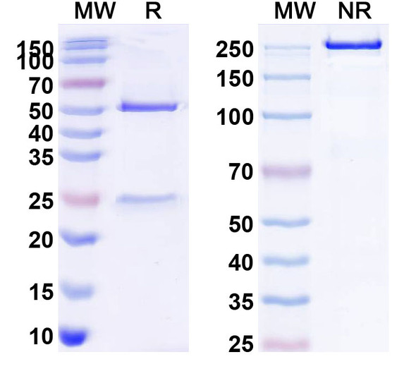 Anti-Human IL1RL1/ST2 Antibody (1A049) - SDS-PAGE