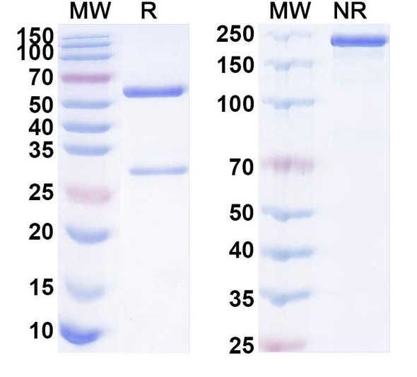 Anti-Human B2M/β2-MG Antibody (1A051) - SDS-PAGE