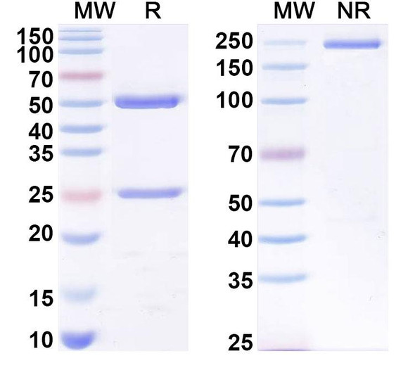 Anti-Human B2M/β2-MG Antibody (1A052) - SDS-PAGE