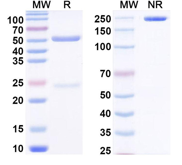 Anti-Pyrroline-5-carboxylate/P5C Monoclonal antibody (1A055) - SDS-PAGE