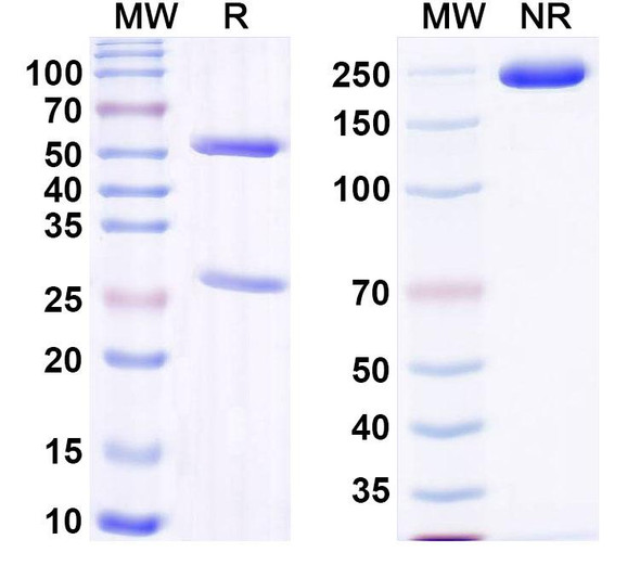 Anti-Nile tilapia NCCRP1 Monoclonal Antibody (1A065) - SDS-PAGE