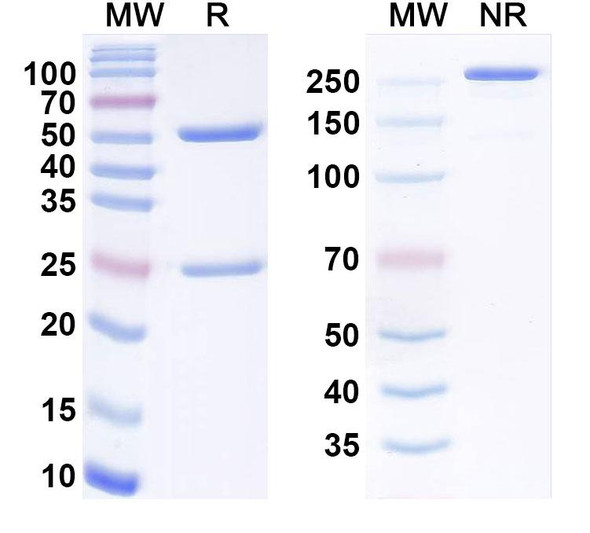 Anti-Human ITGBL1 Monoclonal Antibody (1A070) - SDS-PAGE