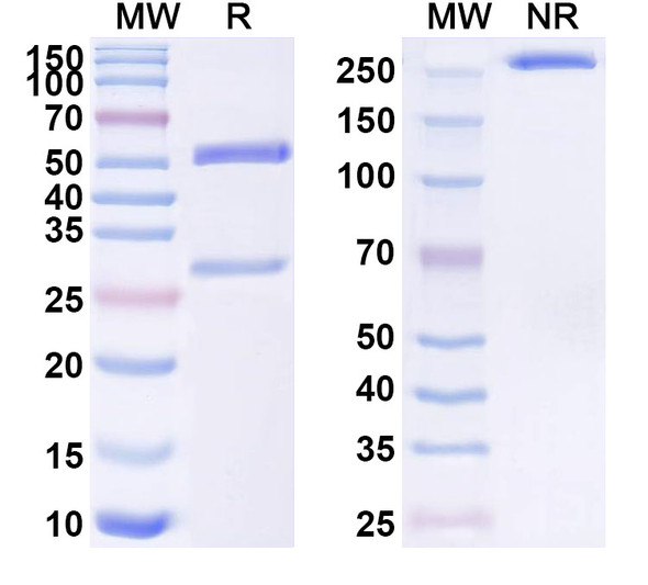 Anti-Human POSTN/OSF-2 Monoclonal Antibody (1A073) - SDS-PAGE