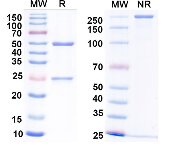 Anti-Agrobacterium sp. aroA/EPSPS Monoclonal Antibody (1A076) - SDS-PAGE