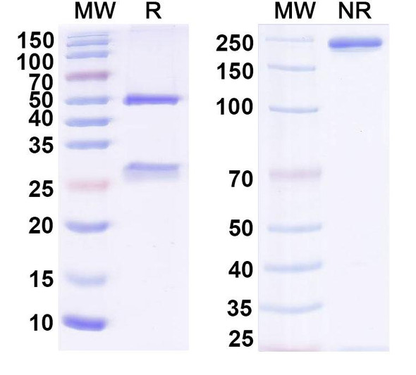 Anti-Human SAA1 Monoclonal Antibody (1A082) - SDS-PAGE