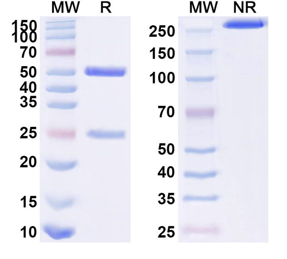 Anti-Human CD66e/CEA/CEACAM5 Monoclonal Antibody (1A089) - SDS-PAGE