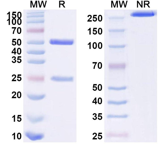 Anti-Human CD66e/CEA/CEACAM5 Monoclonal Antibody (1A089) - SDS-PAGE