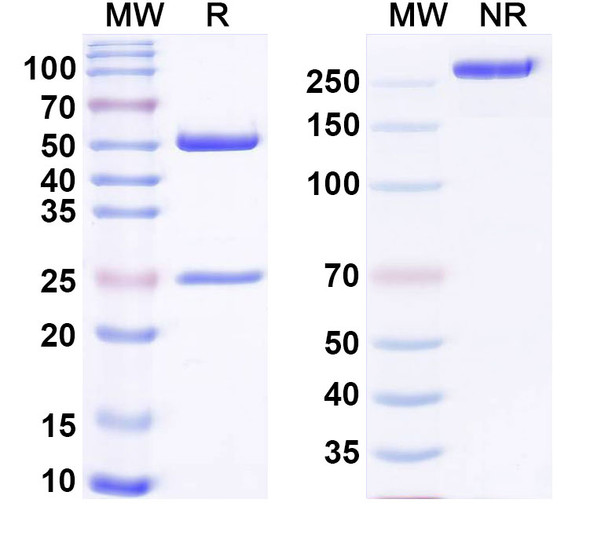 Anti-Human FLT1 Monoclonal Antibody (1A115) - SDS-PAGE