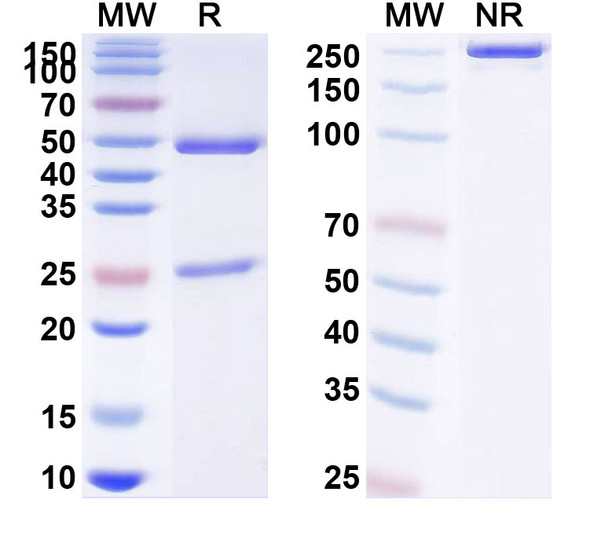 Anti-Human MOSPD2 Monoclonal Antibody (1A129) - SDS-PAGE