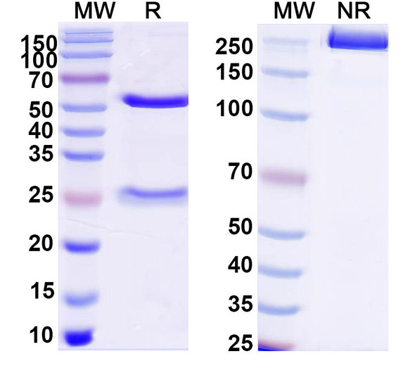 Anti-Human RAD23B/HR23B Monoclonal Antibody (1A135) - SDS-PAGE