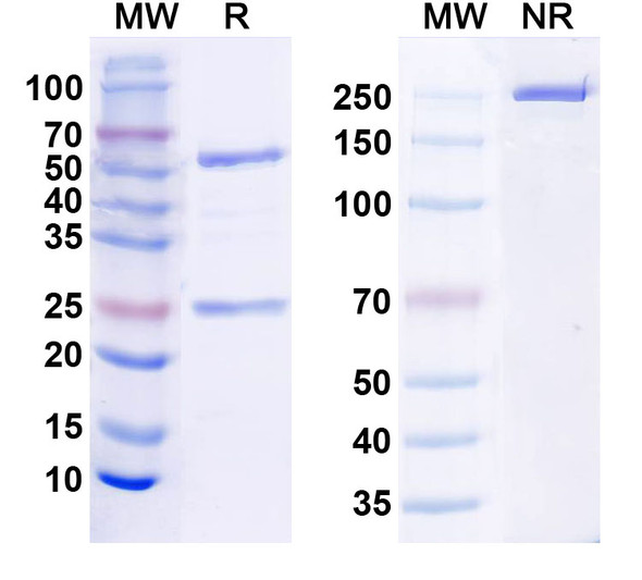 Anti-Human KLB/Beta-klotho Monoclonal Antibody (1A138) - SDS-PAGE