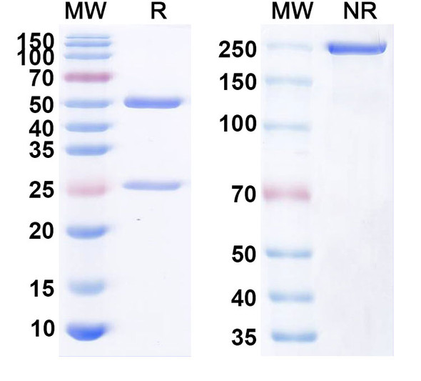 Anti-Human PADI4 Monoclonal Antibody (1A153) - SDS-PAGE
