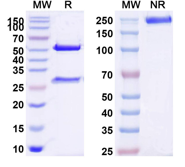 Anti-SARS-CoV-2 RBD Monoclonal Antibody (1A162) - SDS-PAGE