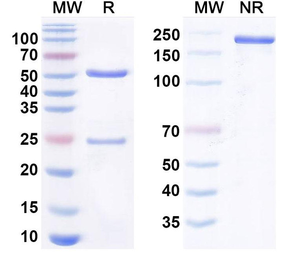 Anti-SARS-CoV-2 NP/Nucleoprotein Monoclonal Antibody (1A164) - SDS-PAGE