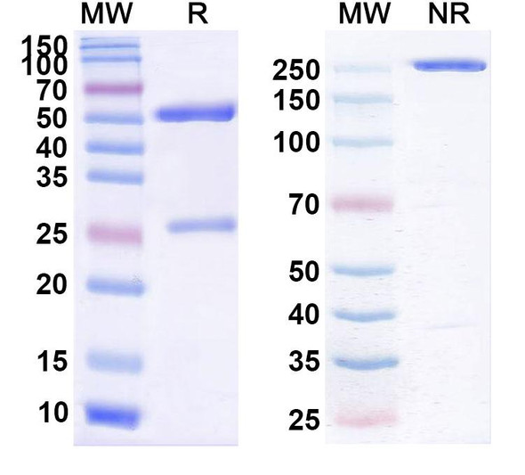 Anti-Helicobacter pylori trxA/Thioredoxin Monoclonal Antibody (1A174) - SDS-PAGE