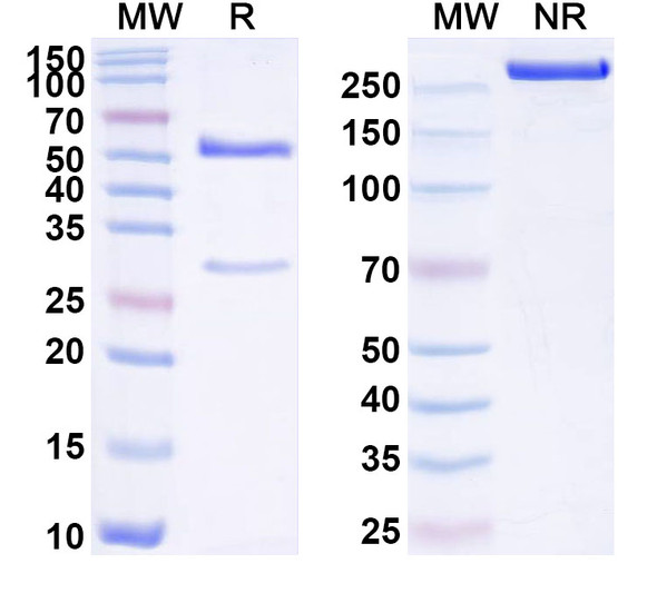Anti-Helicobacter pylori trxA/Thioredoxin Monoclonal Antibody (1A175) - SDS-PAGE