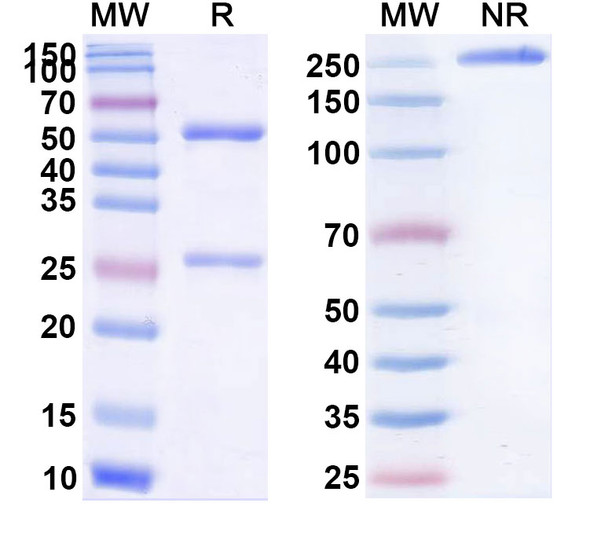 Anti-Listeria monocytogenes serovar 1/2a IAP Monoclonal Antibody (1A180) - SDS-PAGE
