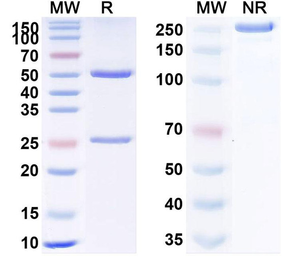 Anti-Bovine Serum Albumin/BSA Monoclonal Antibody (1A228) - SDS-PAGE