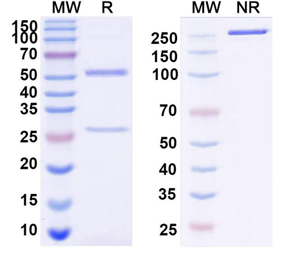 Anti-Mouse TMEM87A Monoclonal Antibody (1A230) - SDS-PAGE