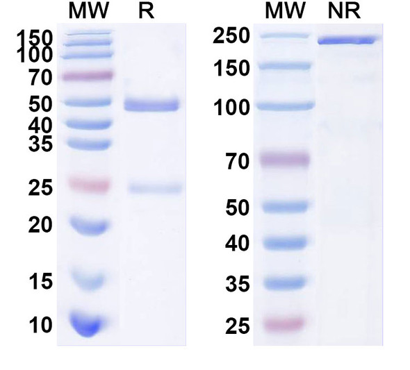 Anti-Mouse TMEM87A Monoclonal Antibody (1A232) - SDS-PAGE