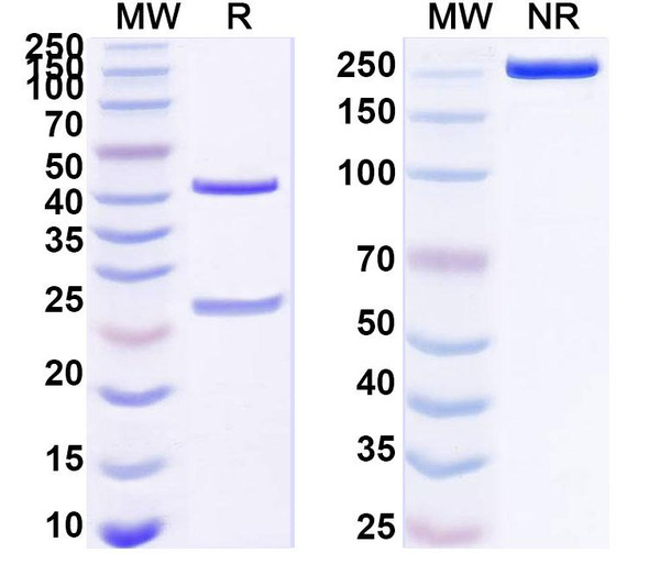 Anti-HBV HBsAg Monoclonal Antibody (1A235) - SDS-PAGE