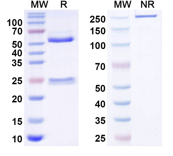 Anti-HBV HBcAg Monoclonal Antibody (1A245) - SDS-PAGE