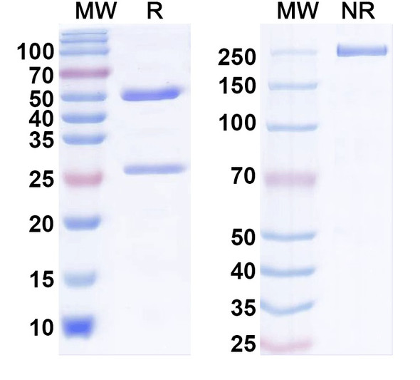 Anti-HBV HBcAg Monoclonal Antibody (1A247) - SDS-PAGE