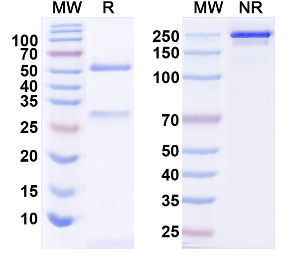 Anti-Clostridium Difficile Toxin B/tcdB Monoclonal Antibody (1A255) - SDS-PAGE