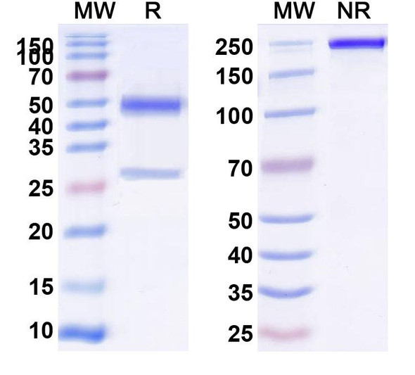Anti-Human total PSA/tPSA Monoclonal Antibody (1A273) - SDS-PAGE
