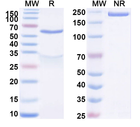 Anti-Human free PSA/fPSA Monoclonal Antibody (1A277) - SDS-PAGE