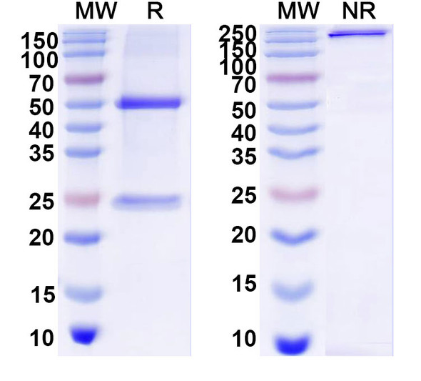 Anti-Human HE4 Monoclonal Antibody (1A285) - SDS-PAGE