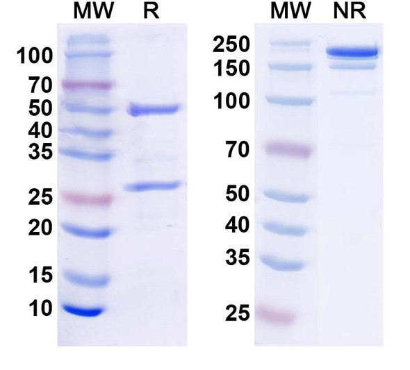 Anti-Human S100B Monoclonal Antibody (1A295) - SDS-PAGE