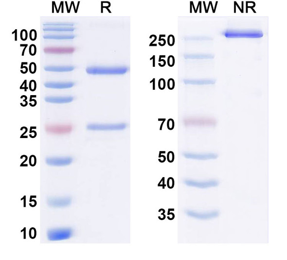 Anti-Human S100B Monoclonal Antibody (1A296) - SDS-PAGE