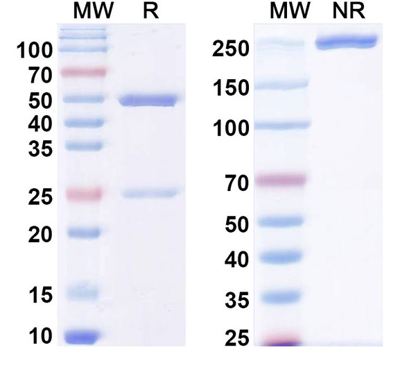 Anti-Human CA19-9/CA199 Monoclonal Antibody (1A300) - SDS-PAGE